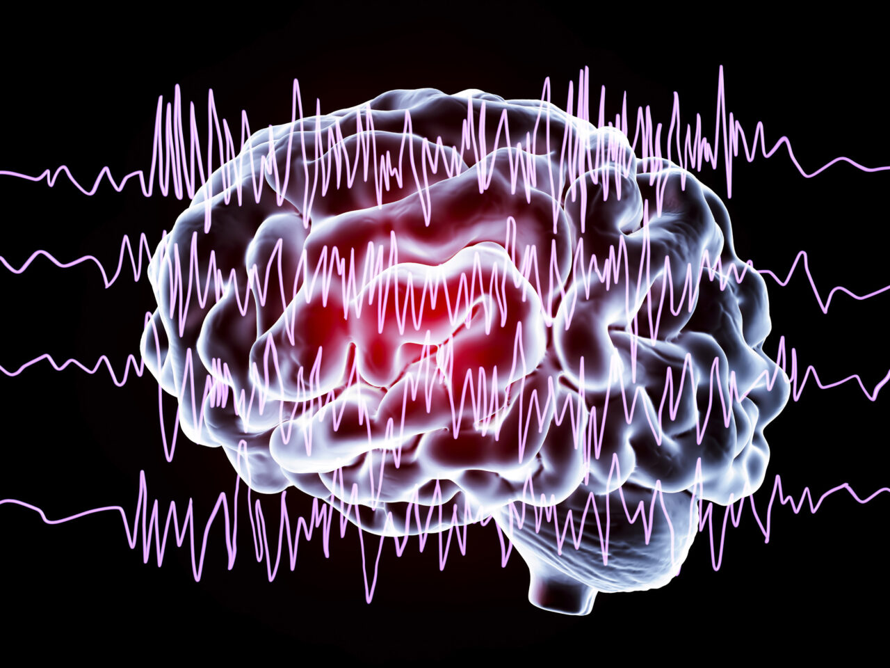 epilepsy awareness
